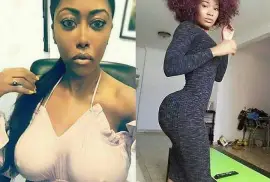 Enlarge Your Curves &amp; Butt Naturally +2771,  1,500.00